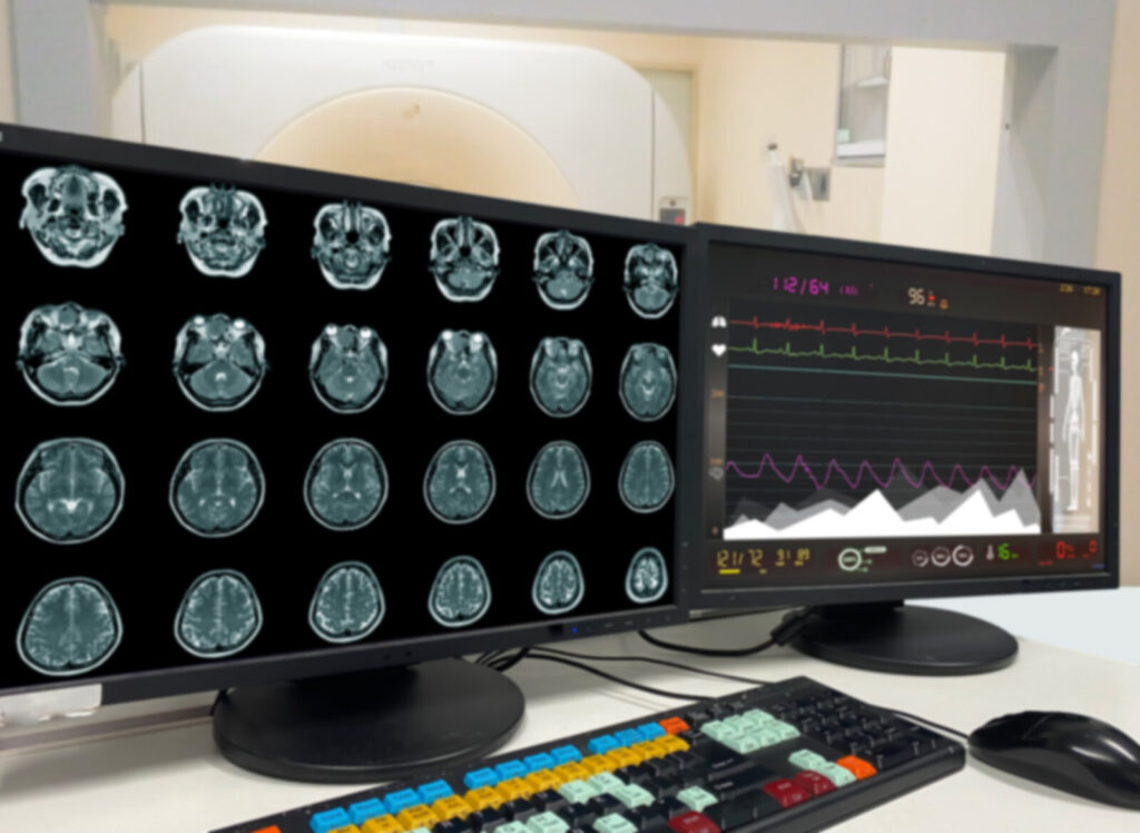 Rows of brain scan slices displayed on two computer monitors