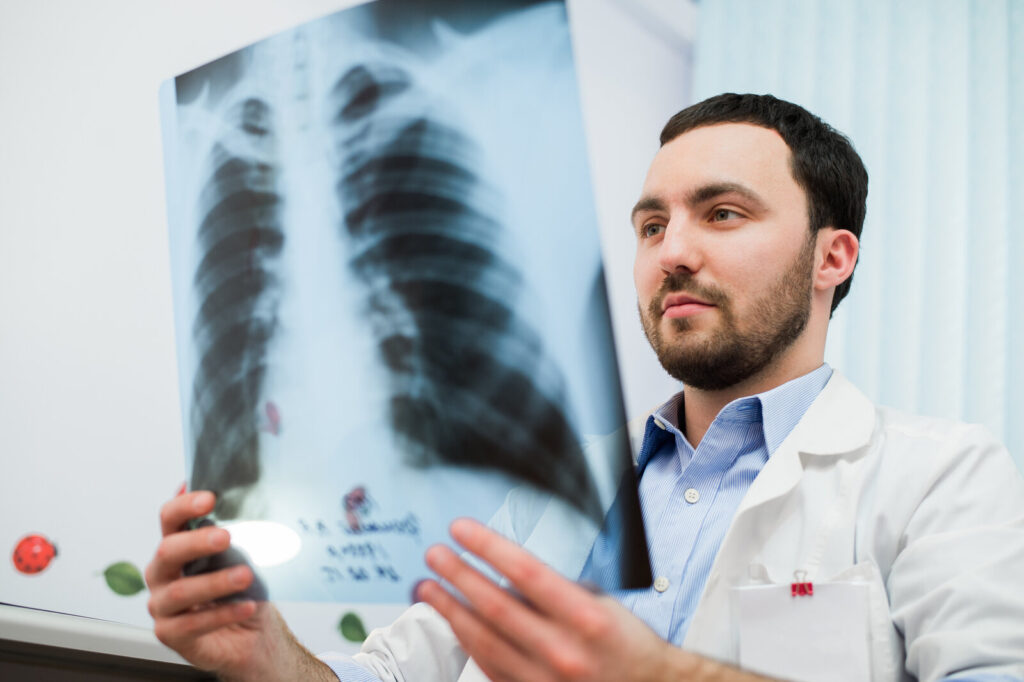 Doctor holding up and studying a chest X-ray