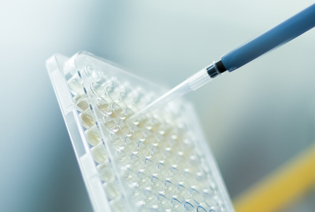 Pipette adding liquid to a clear plastic plate with many small wells in a laboratory