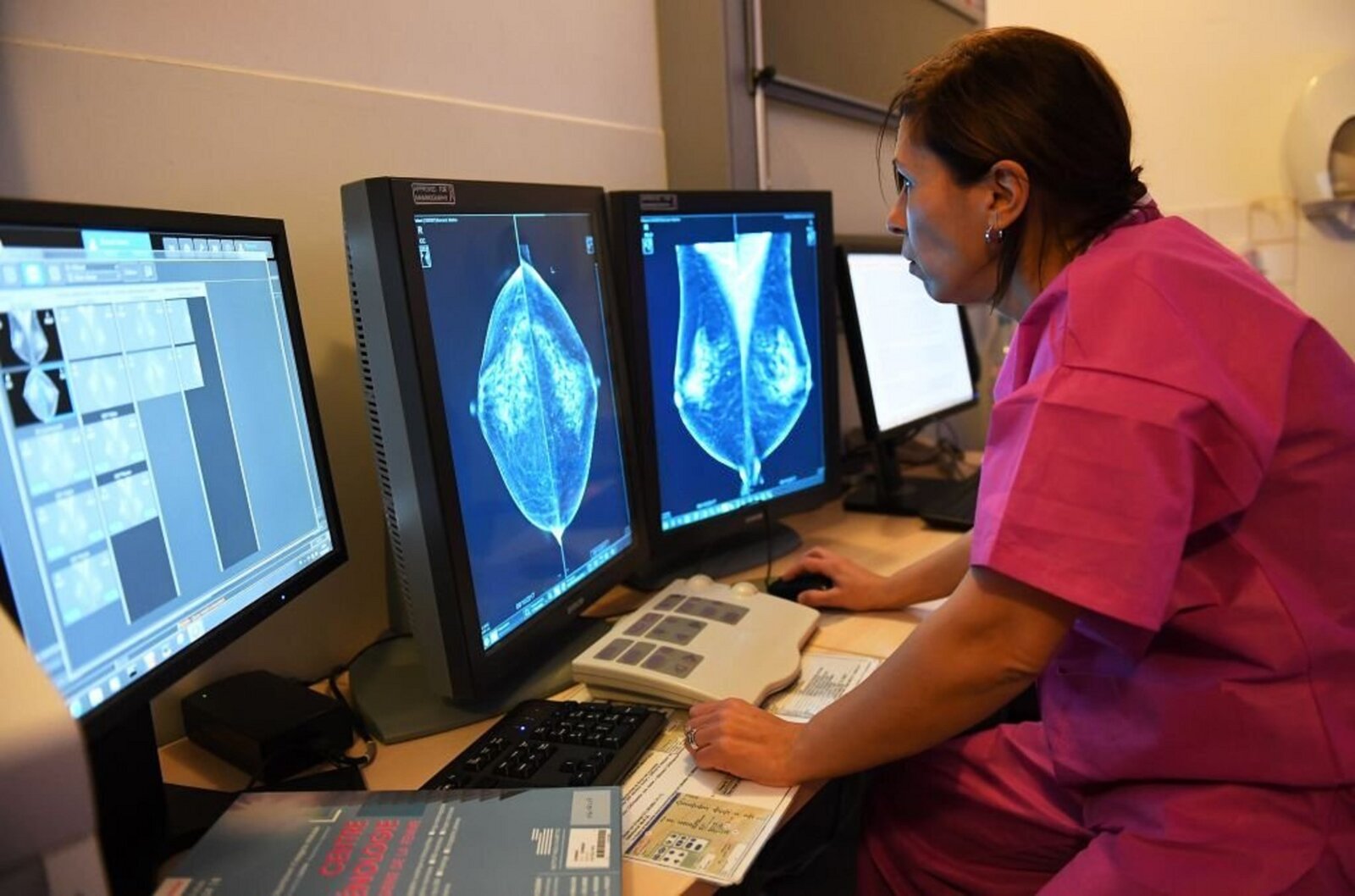 Radiologist reading mammograms on dual high resolution monitors at a breast imaging workstation
